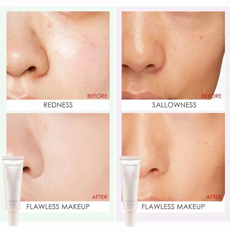 Skin Color Redness Dullness Acne Fixer